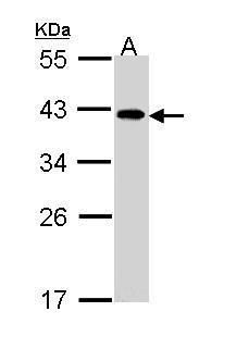 EIF2B beta Rabbit Polyclonal Antibody