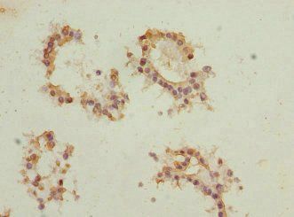 EIF2B1 Antibody
