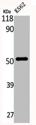 EIF2B3 antibody