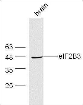 eIF2B3 antibody