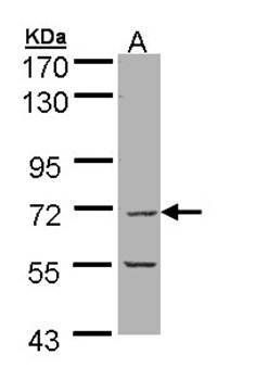 eIF2Bdelta antibody
