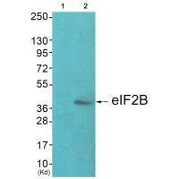 EIF2S2 (Ab-67) Antibody
