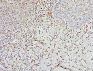 EIF2S3 Antibody