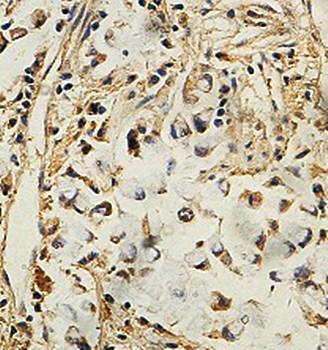 EIF2S3 Rabbit Polyclonal Antibody