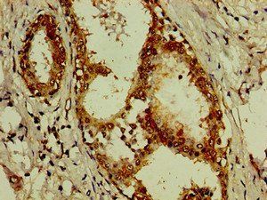 ACTN4 Antibody