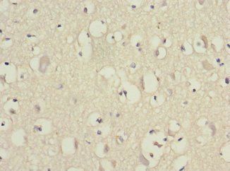 EIF3F Antibody