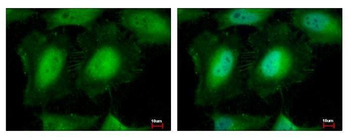 EIF3K antibody [N1C2]