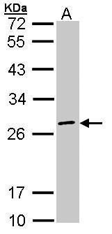 EIF3K Rabbit Polyclonal Antibody