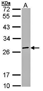 eIF3K antibody