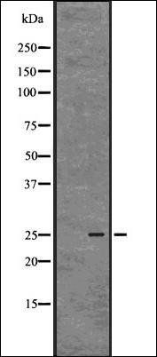 eIF4E (Phospho-S209) antibody