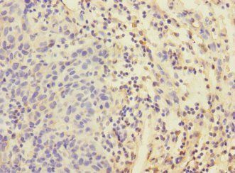 EIF4E2 Antibody