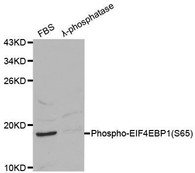 EIF4EBP1 (phospho-Ser65) antibody
