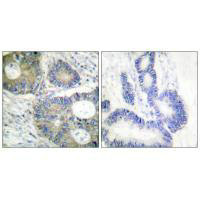 EIF4EBP1 (Ab-64) Antibody