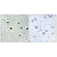 EIF4EBP1 (Ab-69) Antibody