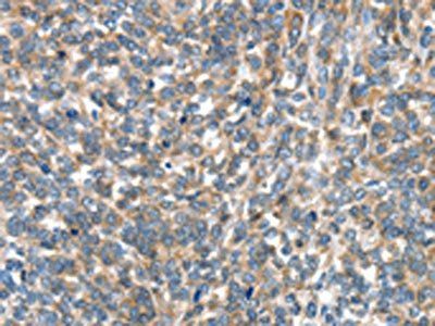 EIF4EBP1 Antibody