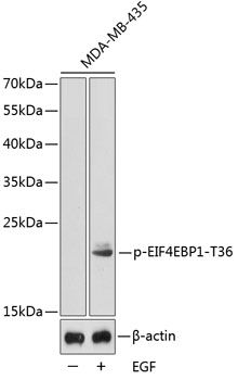 EIF4EBP1 (Phospho-T36) antibody