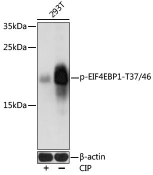 EIF4EBP1 (Phospho-T37/46) antibody