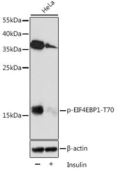 EIF4EBP1 (Phospho-T70) antibody
