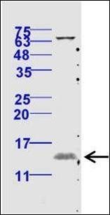 eIF4EBP1(Thr70) antibody