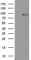 EIF4EL3 (EIF4E2) antibody
