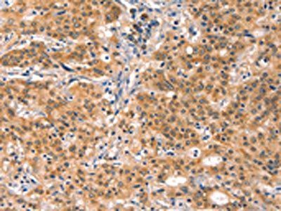 EIF4G1 antibody