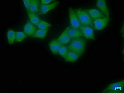 EIF4G2 antibody