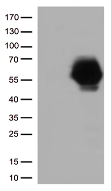 EIF5A2 antibody