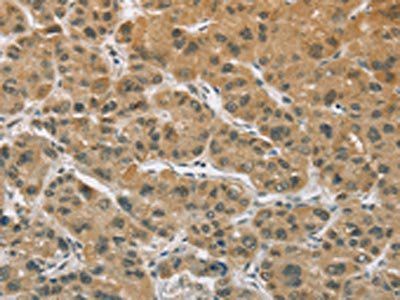 ELAC2 antibody