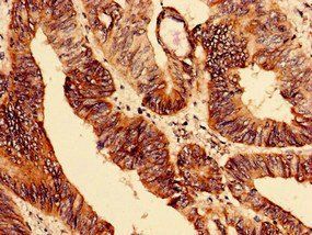 ELAVL2 Antibody