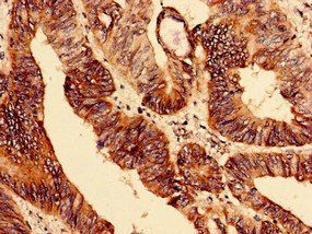 ELAV-like protein 2 antibody