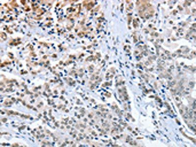 ELAVL1 antibody