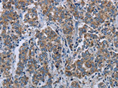 ELAVL3 Antibody