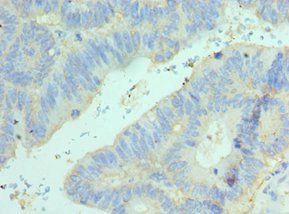 ELF4 Antibody
