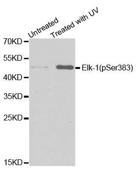 ELK1 (phospho-Ser383) antibody
