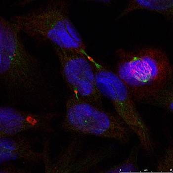 Elk1 (Ab-389) Antibody