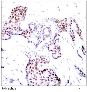 Elk1 (Phospho-Ser389) Antibody