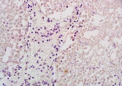 ELL2 Rabbit Polyclonal Antibody