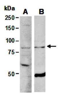 ELL2 antibody