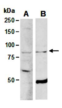 ELL2 antibody pair