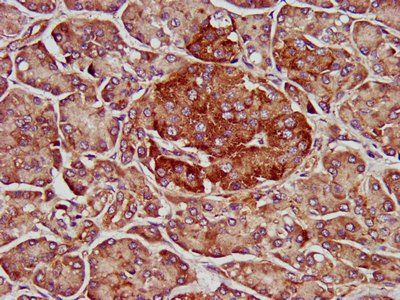 ELMOD3 Antibody
