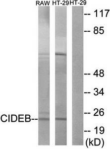 CIDEB Antibody