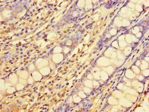 ELOVL1 Antibody