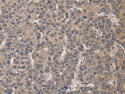 ELOVL1 Antibody