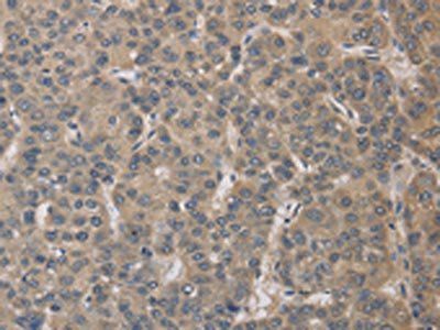 ELOVL1 antibody