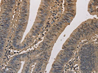ELOVL1 Antibody