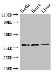 ELOVL4 Antibody
