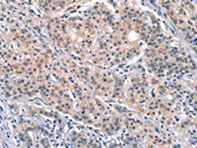 ELOVL6 Antibody
