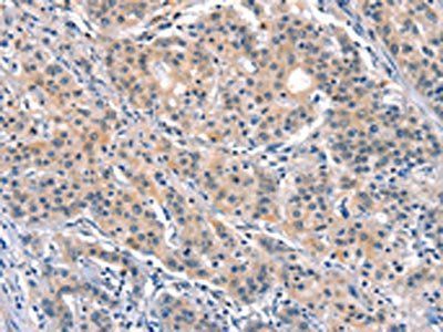 ELOVL6 antibody