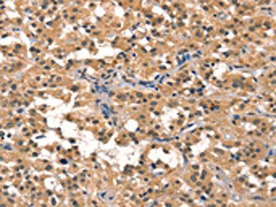 ELOVL6 Antibody