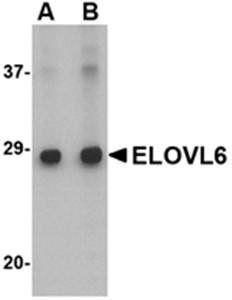 ELOVL6 Antibody
